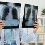 Tratamento de doenças respiratórias - Dr. Cyro Teixeira da Silva Junior