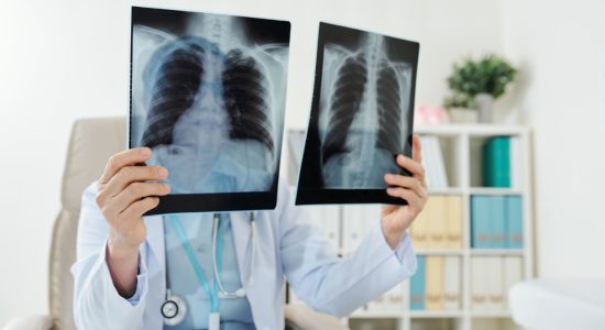 Tratamento de doenças respiratórias - Dr. Cyro Teixeira da Silva Junior